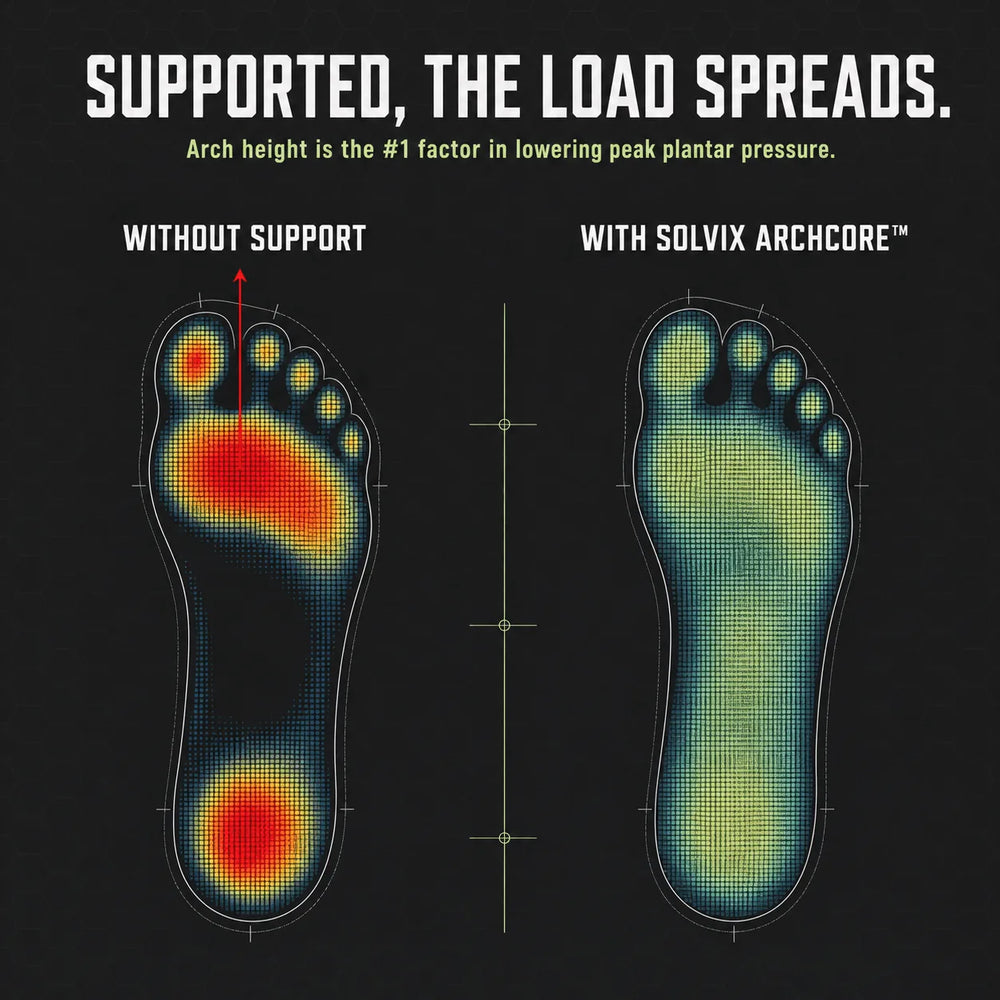 Foot pressure heatmap — red where the collapsed arch piles the pressure